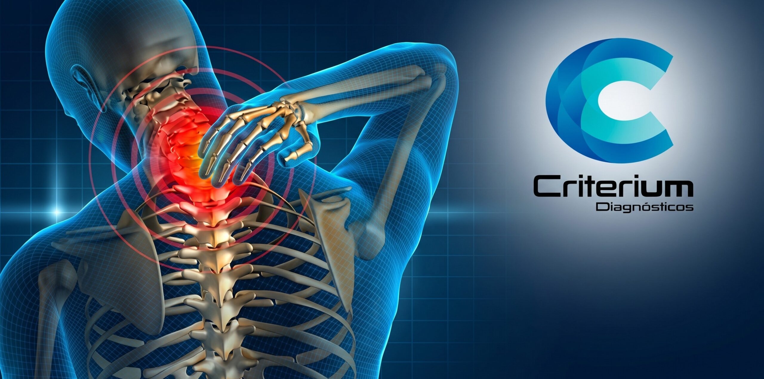 Ressonância de coluna cervical em Fortaleza: quando fazer e quais sintomas investigar