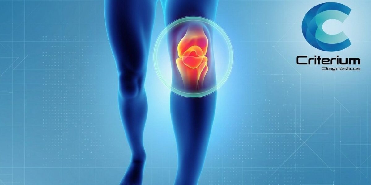 Lesão de ligamento do joelho em Fortaleza: quando suspeitar e qual exame fazer